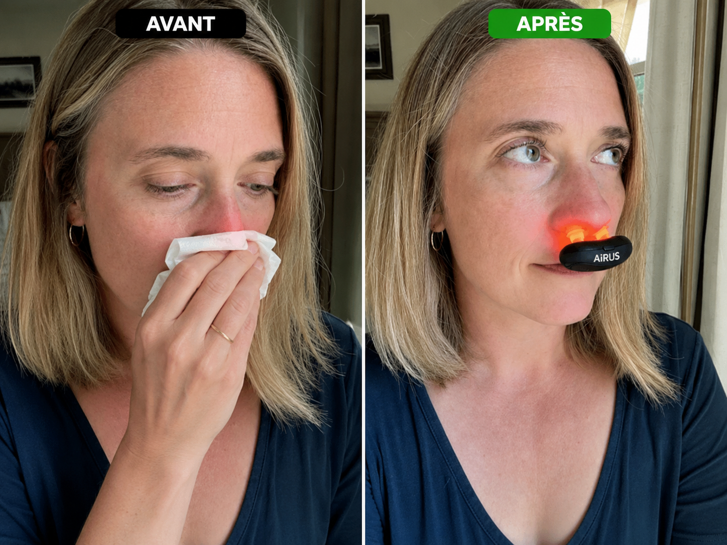 Appareil de Photothérapie Nasale Intelligente